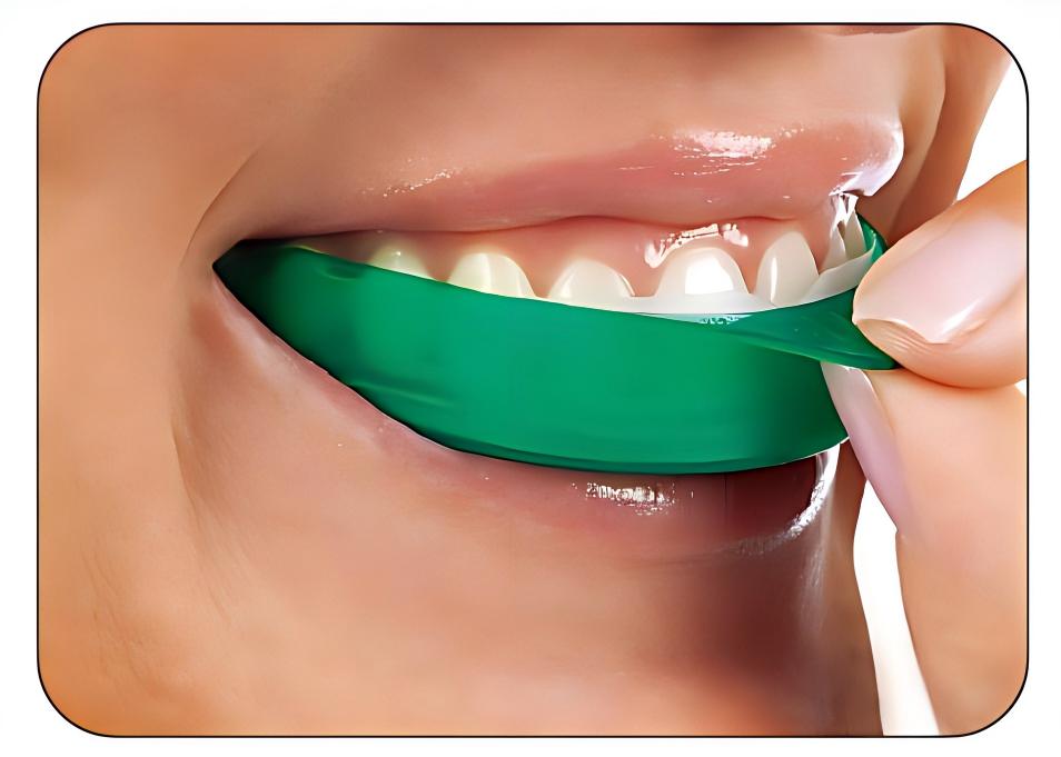 Teeth Whitening Opalescence Go - Ultradent Opalescence Go Teeth Whitening Strips