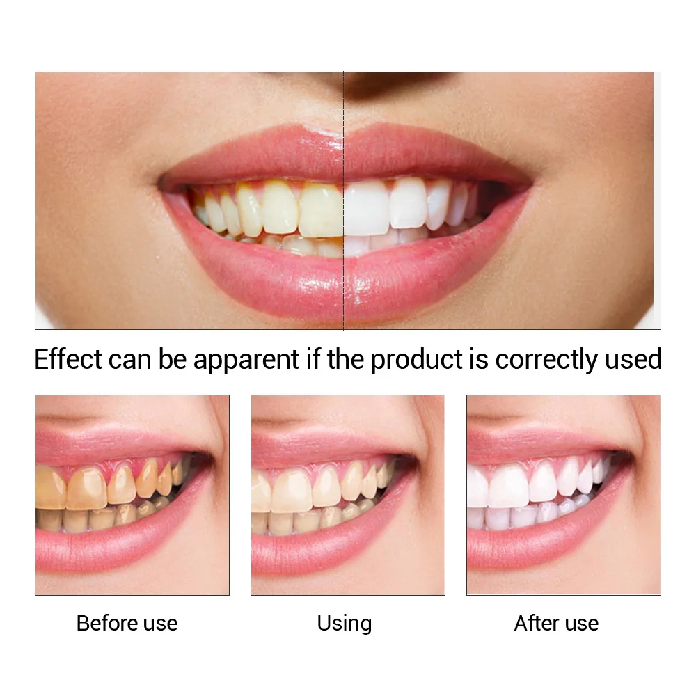FTEENPLY Teeth Whitening Essen - Teeth Whitening Powder recension och pris