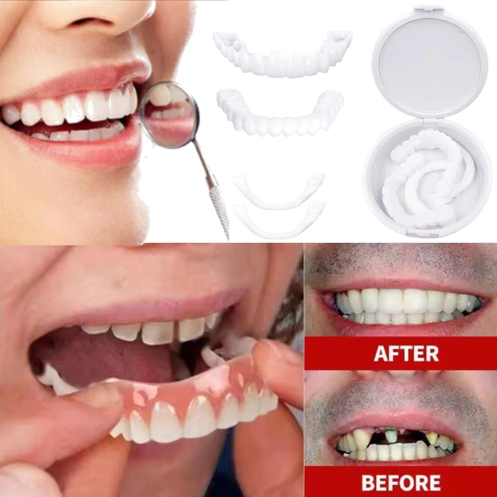 New Charming Smile Teeth Venee - Teeth Whitening Uneven recension och pris