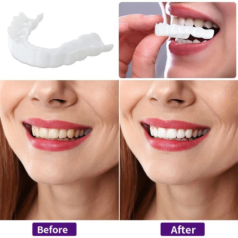 New Defect Repair Teeth Veneer - Teeth Whitening Uneven recension och pris