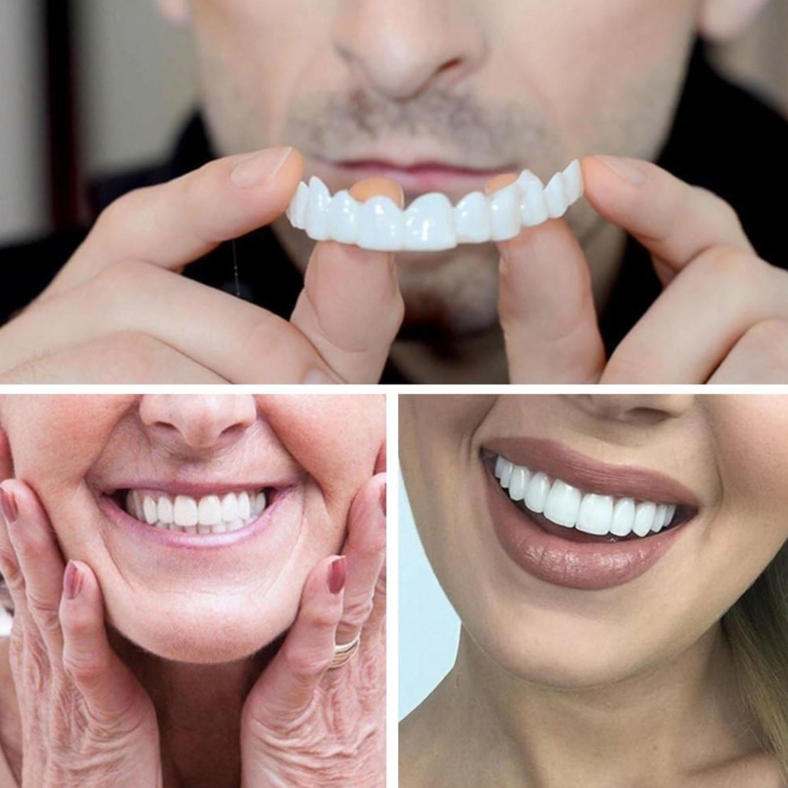 New Defect Repair Teeth Veneer - Teeth Whitening Uneven recension och pris