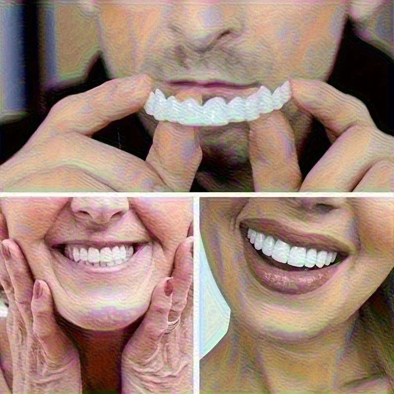 New Uneven Teeth Fix Veneers R - Teeth Whitening Uneven recension och pris