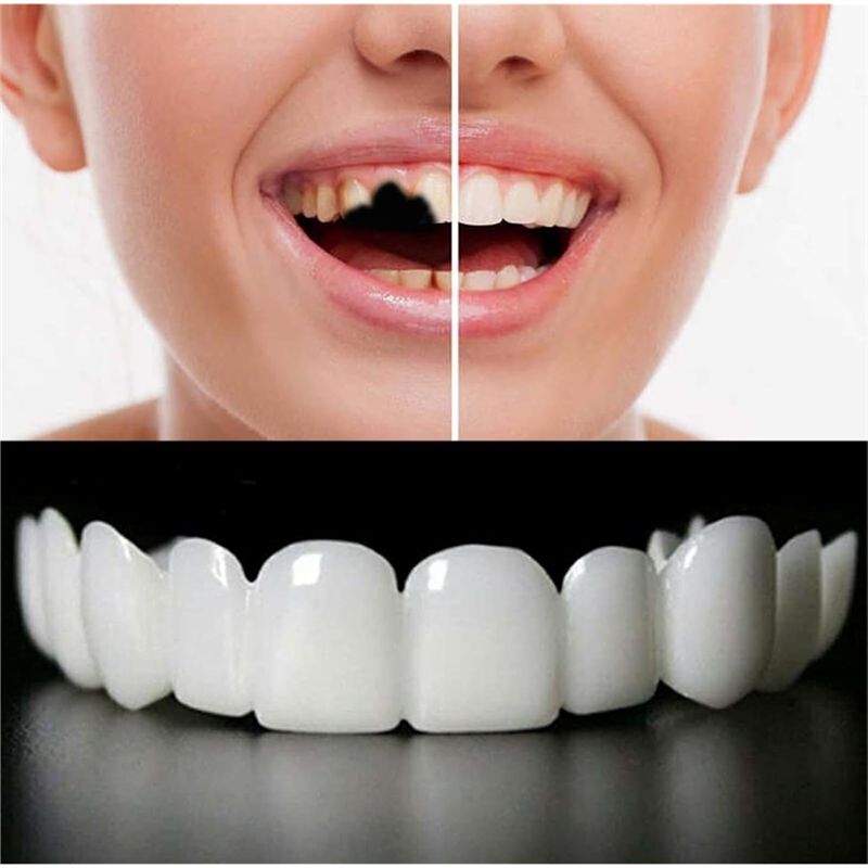 New Reusable Temporary False T - Teeth Whitening Uneven recension och pris