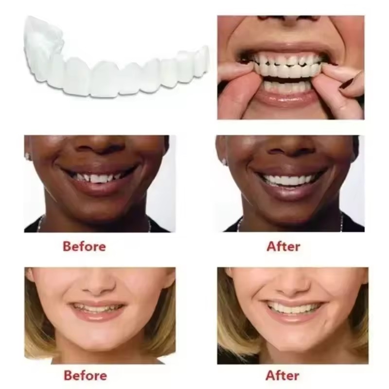 New Reusable Temporary False T - Teeth Whitening Uneven recension och pris